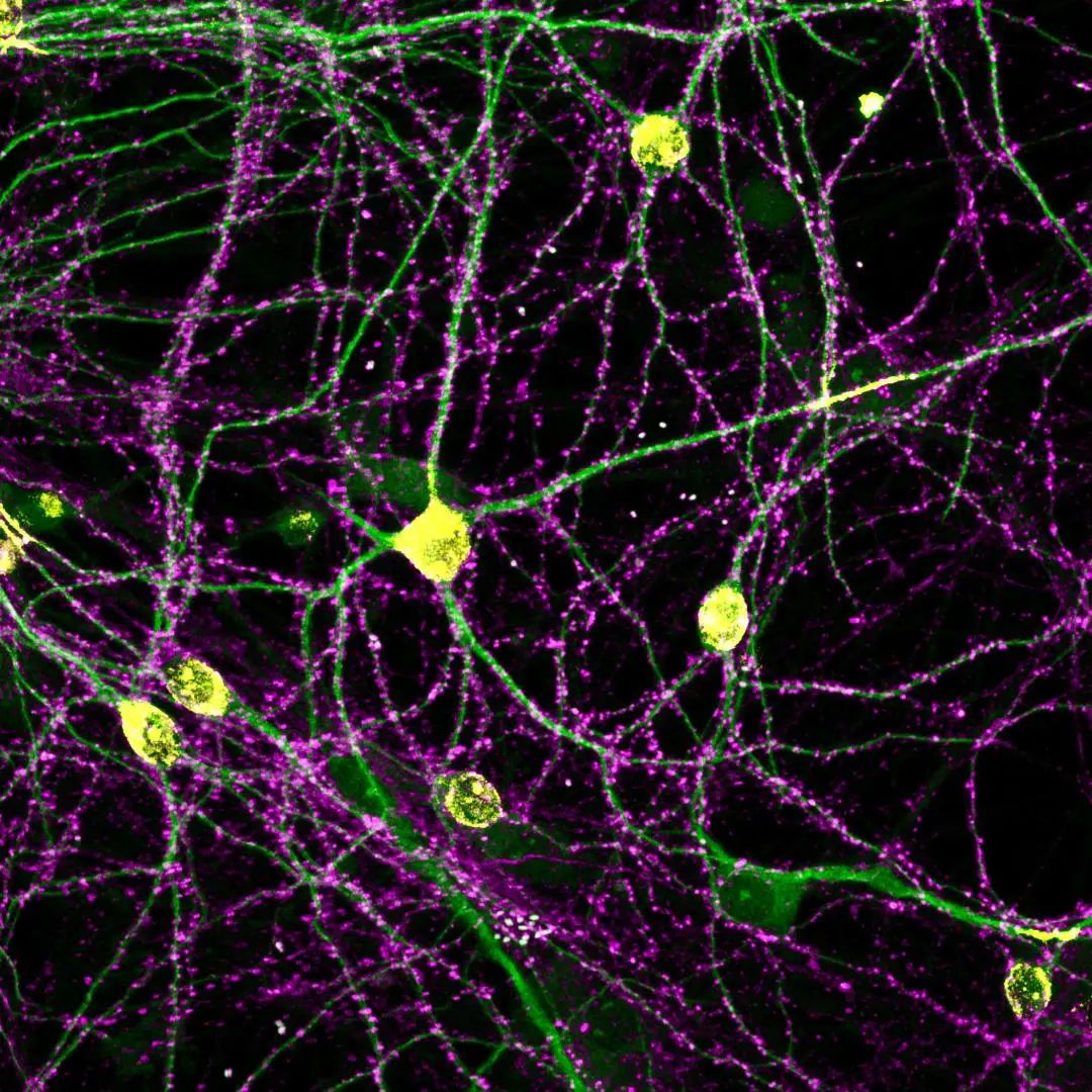 Nature|首次！杏鑫娱乐工團隊揭示突觸群體組織原則𓀇，研究或有助于抵抗大腦衰老